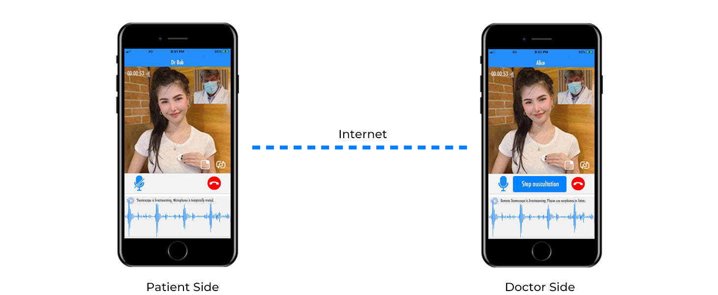 livestreaming the electronic digital stethoscope sounds over internet